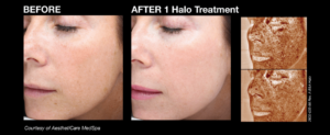 halo_before_and_afters_2_final