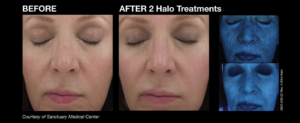 halo_before_and_afters_6_final