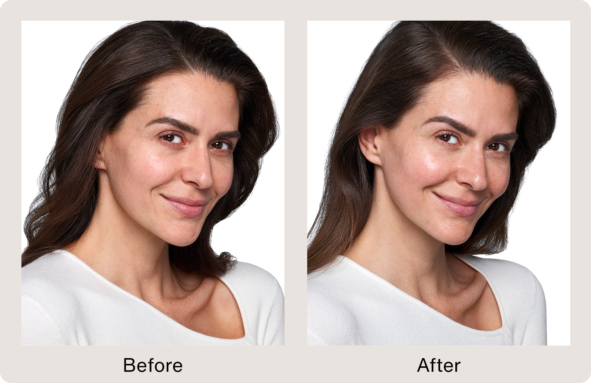 glutathione injections grand rapids SkinVive In Grand Rapids Grand Rapids, MI
